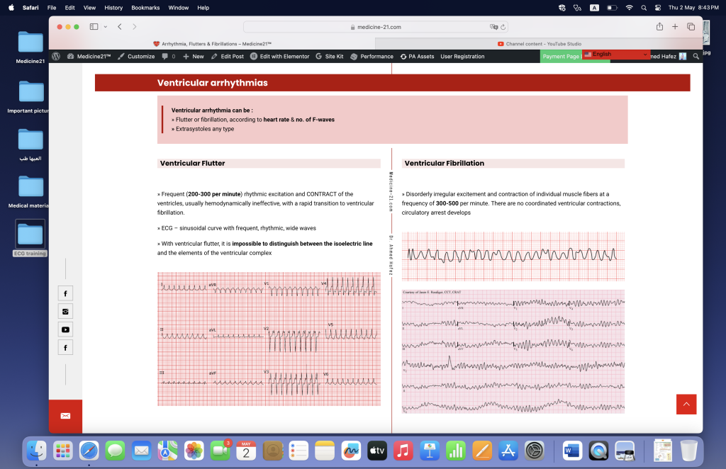 Arrhythmia, Flutters and Fibrillations